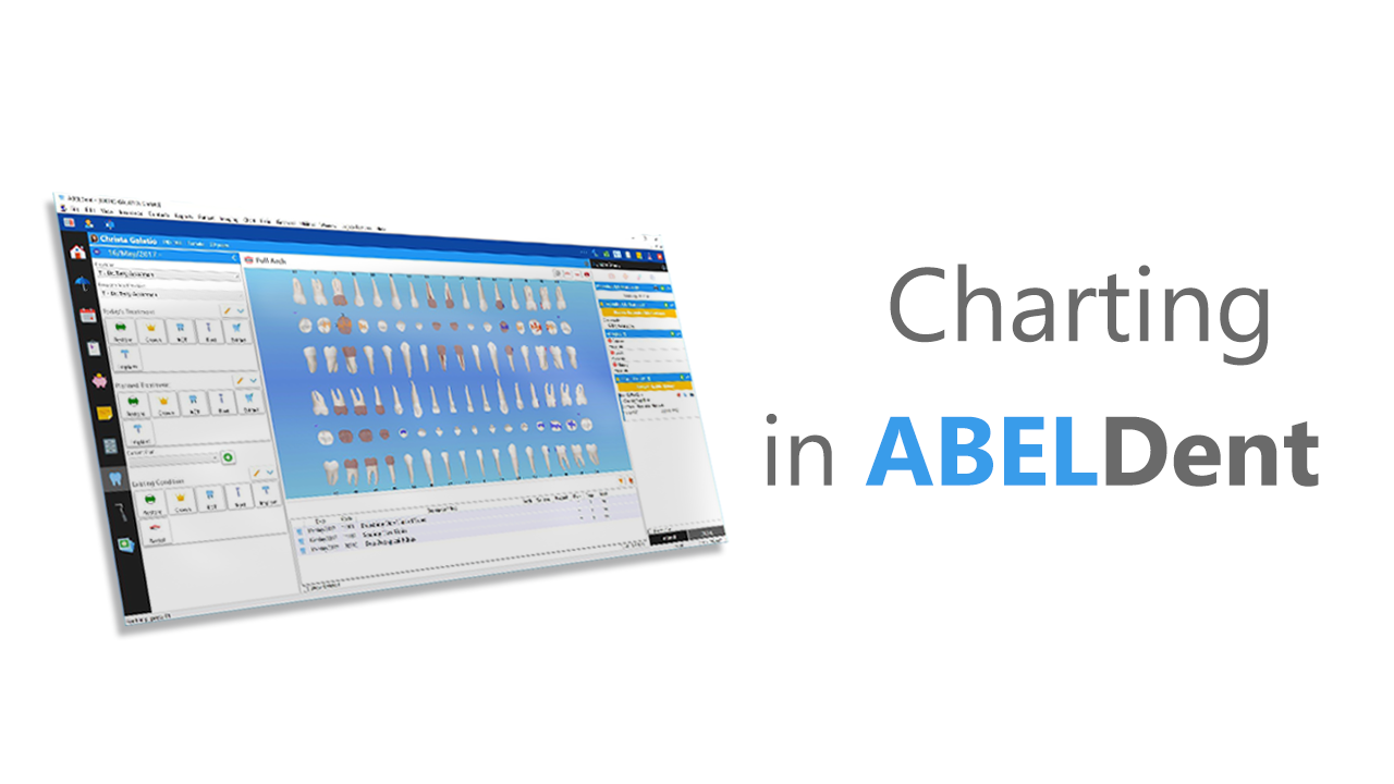 Simplified Charting in ABELDent CS and LS+